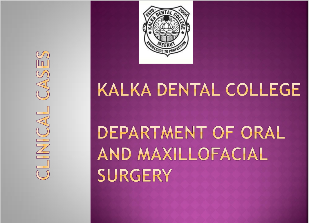10 Things I Wish I Knew About price of veneers in India