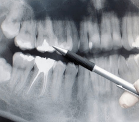 Oral Medicine & Radiology