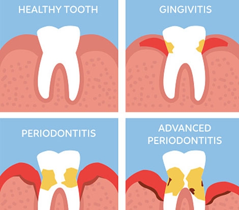 Periodontics & Oral Implantology