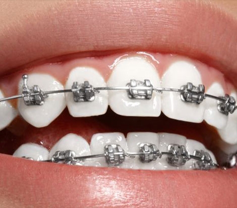 Orthodontics & Dentofacial Orthopaedics