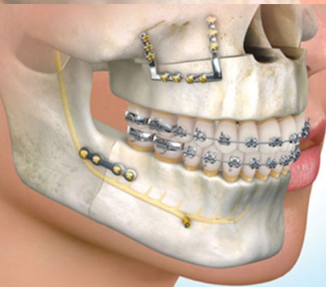 Oral & Maxillofacial Surgery